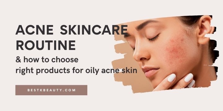 Acne Skin Care Routine & How To Choose Right Products For Oily Skin